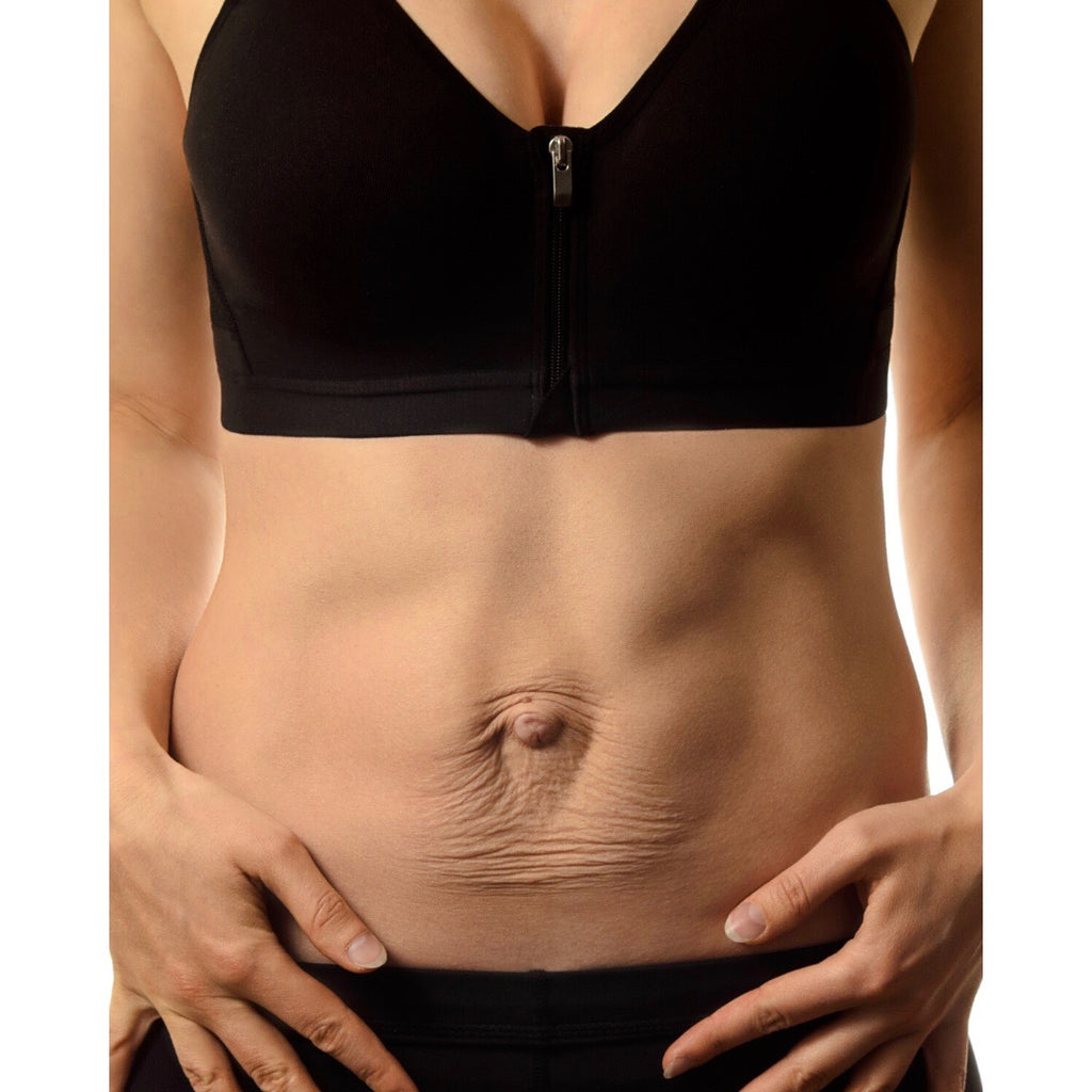 Diastasis Recti Band - Top Quality Diastasis Recti Band can be Availed in  the Best Price Now! - Wattpad