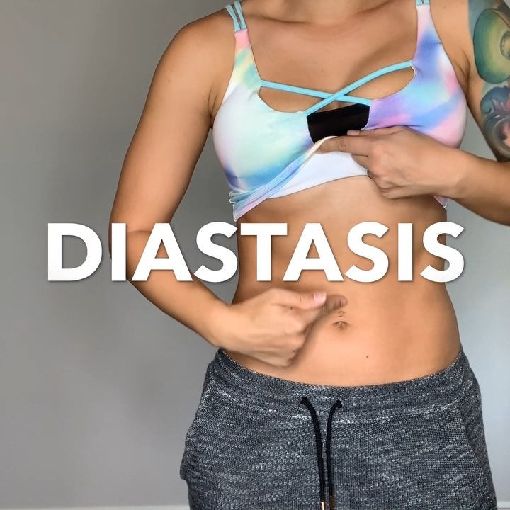 Diastasis Recti Workout with Sia!