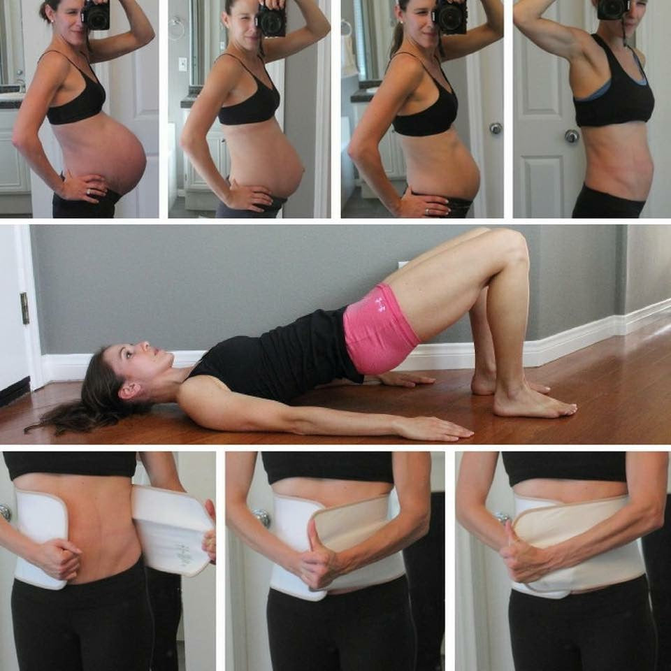 Healing Diastasis Recti – Belly Bandit